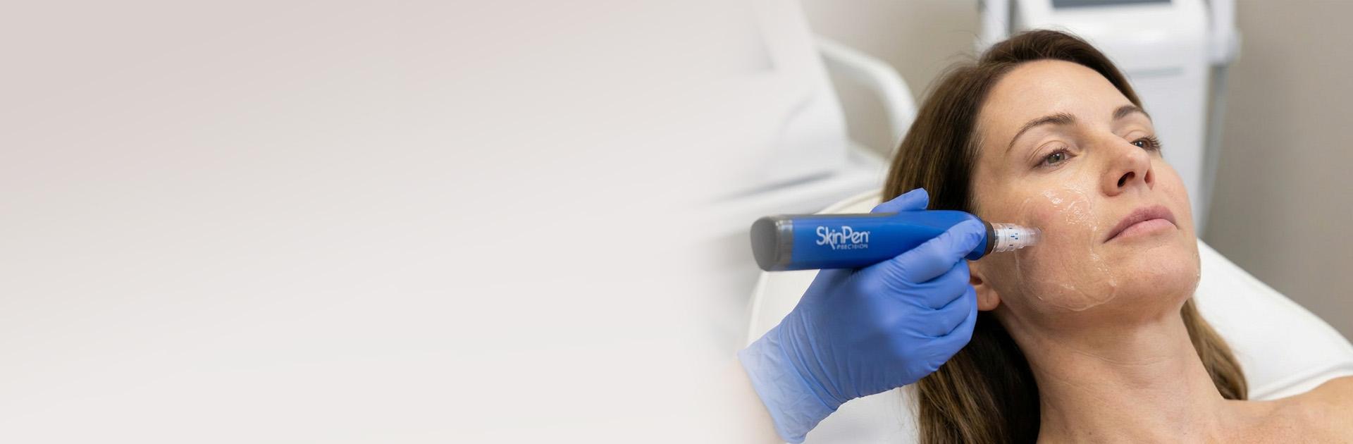 Skin Microneedling